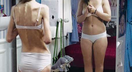 Problemy z odżywianiem – bulimia i anoreksja
